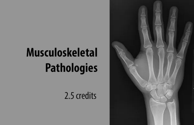 Musculoskeletal Pathologies