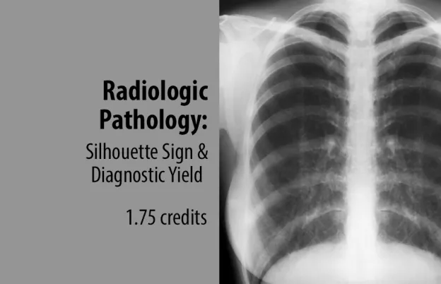 Radiologic Pathology: Silhouette Sign and Diagnostic Yield